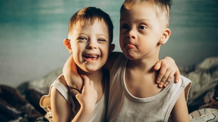 Благотворительный фотопроект об особенных детях «Какой ты красивый» — фото 7